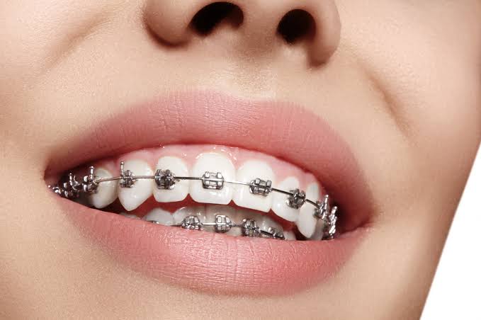 Orthodontics